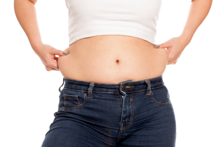 Tummy Tuck